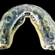 Illustration for article titled Confessions Of A Tooth Grinder